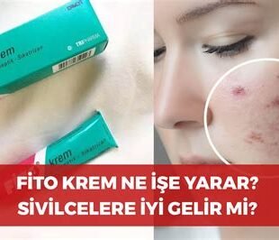 Fito krem ne işe yarar