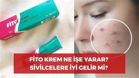 Fito krem ne işe yarar